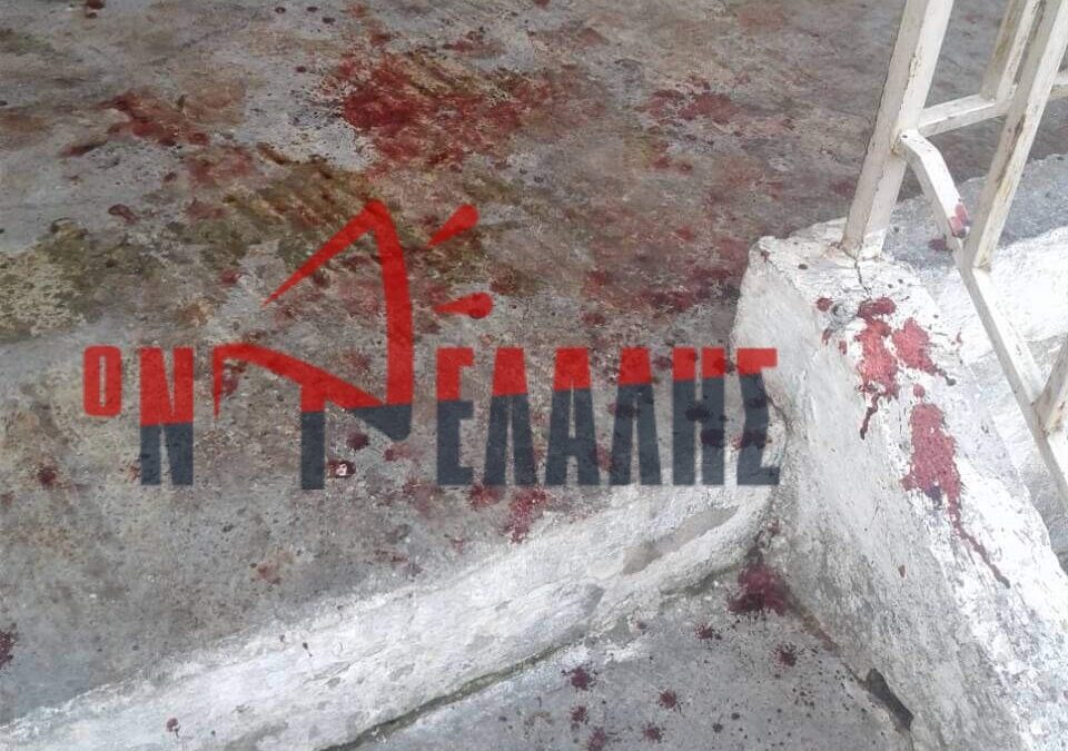Σοκ στην Κατερίνη: Γυναίκα μαχαίρωσε τον σύντροφό της (ΦΩΤΟ)