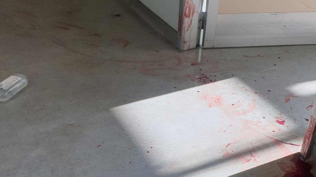 Εικόνες φρίκης μέσα από το Αττικόν – Καρέ καρέ πως 59χρονος μαχαίρωσε νοσηλεύτρια πριν αυτοκτονήσει