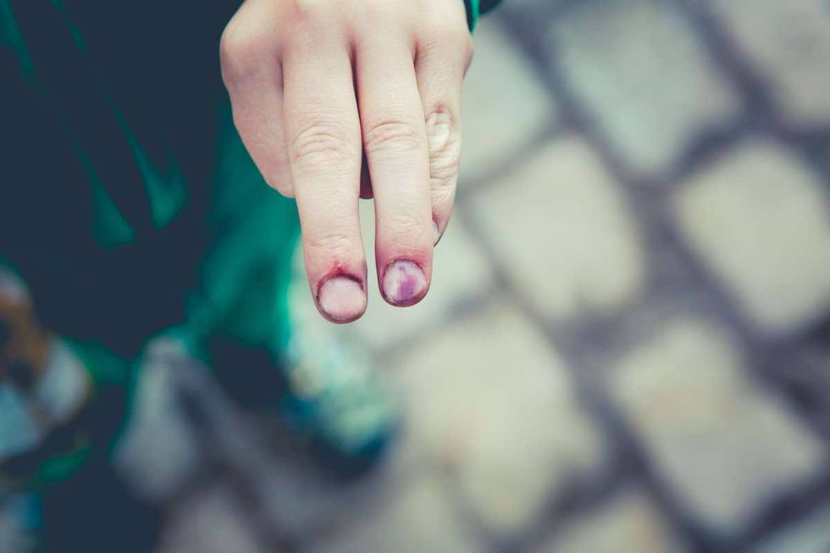 Ο ρόλος του δερματολόγου στην πρόληψη και την αντιμετώπιση δερματικών παθήσεων