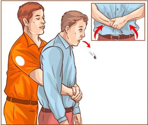 Σώζοντας ζωές: Πώς εφαρμόζεται η «λαβή Heimlich» σε περίπτωση πνιγμού (vid)