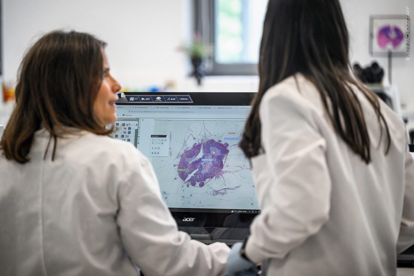 Σχέδιο κατά του καρκίνου: Οι ευρωβουλευτές ζητούν σταθερή χρηματοδότηση έως το ’34